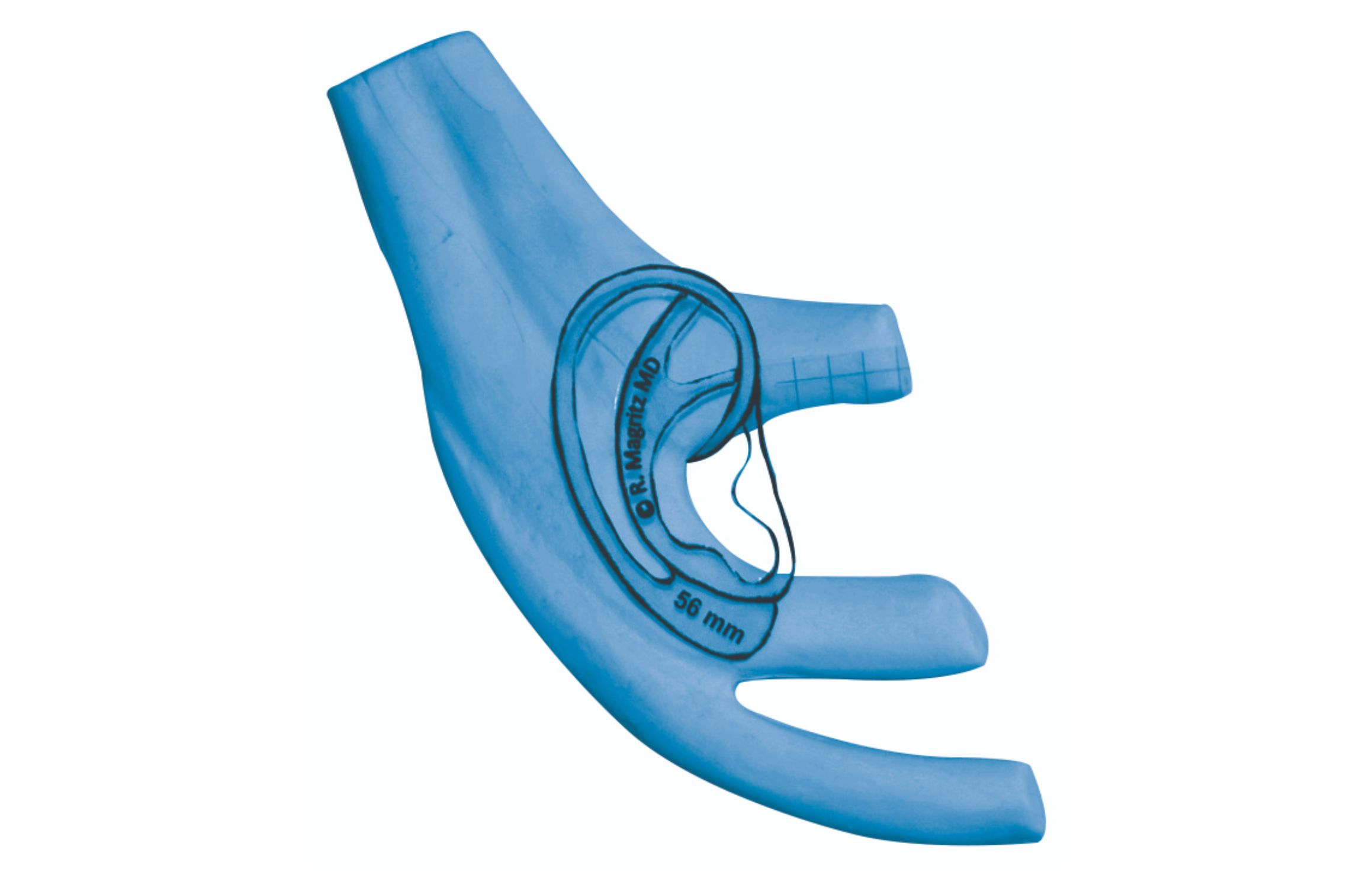Medicon Auricular Reconstruction